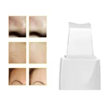 Συσκευή υπερήχων για cavitation peeling προσώπου με 3 λειτουργίες και USB