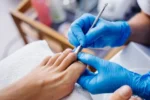 Σετ Εργαλείων Μανικιούρ Πεντικιούρ 5 τεμαχίων Inox INGROWN NAILS KIT